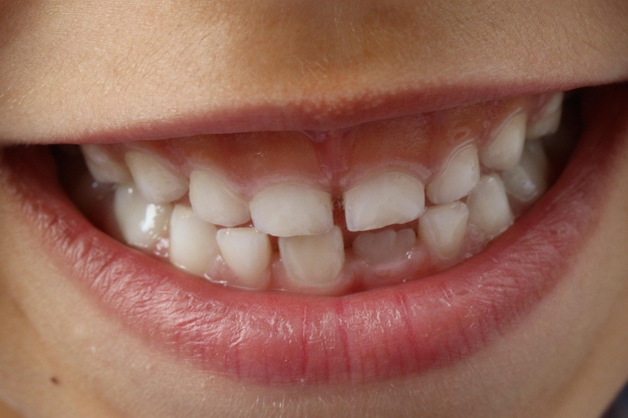 dents du bonheur